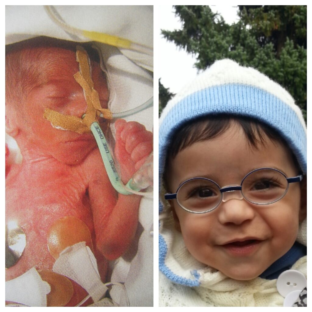 MUCİZE BEBEK YAHYA RÜMEYSANIN ELLERİ