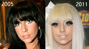 Lady Gaga Plastic Surgery on Chatter Busy  Lady Gaga Plastic Surgery