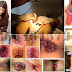 Obat Wasir (Hemoroid) De Nature Asli indonesia thumbnail