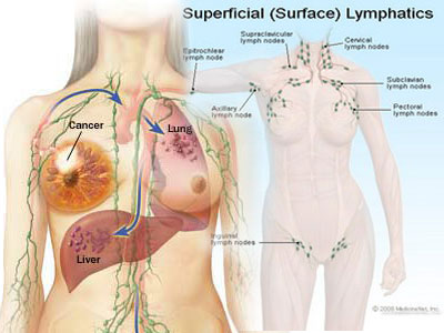 BREAST CANCER RISK
