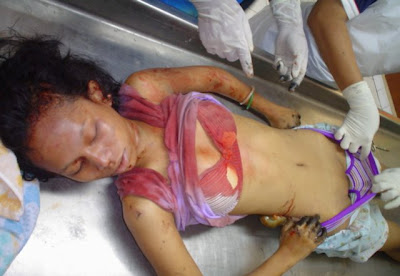 GAMBAR BEDAH SIASAT MANGSA ROGOL
