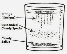 S Boulardii And Natural Antifungals S Boulardii And Natural Antifungals