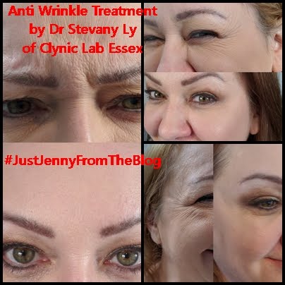 Botox by Dr Stevani Ly Clynnic Lab Essex