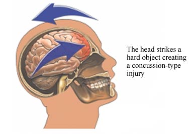 Sidney Crosby update.