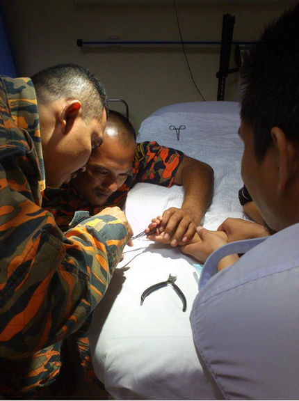 SERIUS : Bomba Memotong Cincin Yang Terlekat Pada Jari Mangsa (4