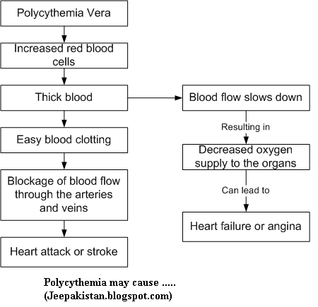Polycythemia Vera Will Result In