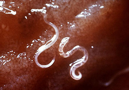 Male Hookworm