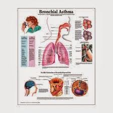 asthma signs and symptoms
