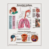 Natural Remedies For Wheezing And Shortness Of Breath Natural Remedies For Wheezing And Shortness Of Breath