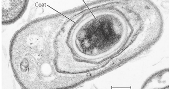 Endospora | Kamus Biologi