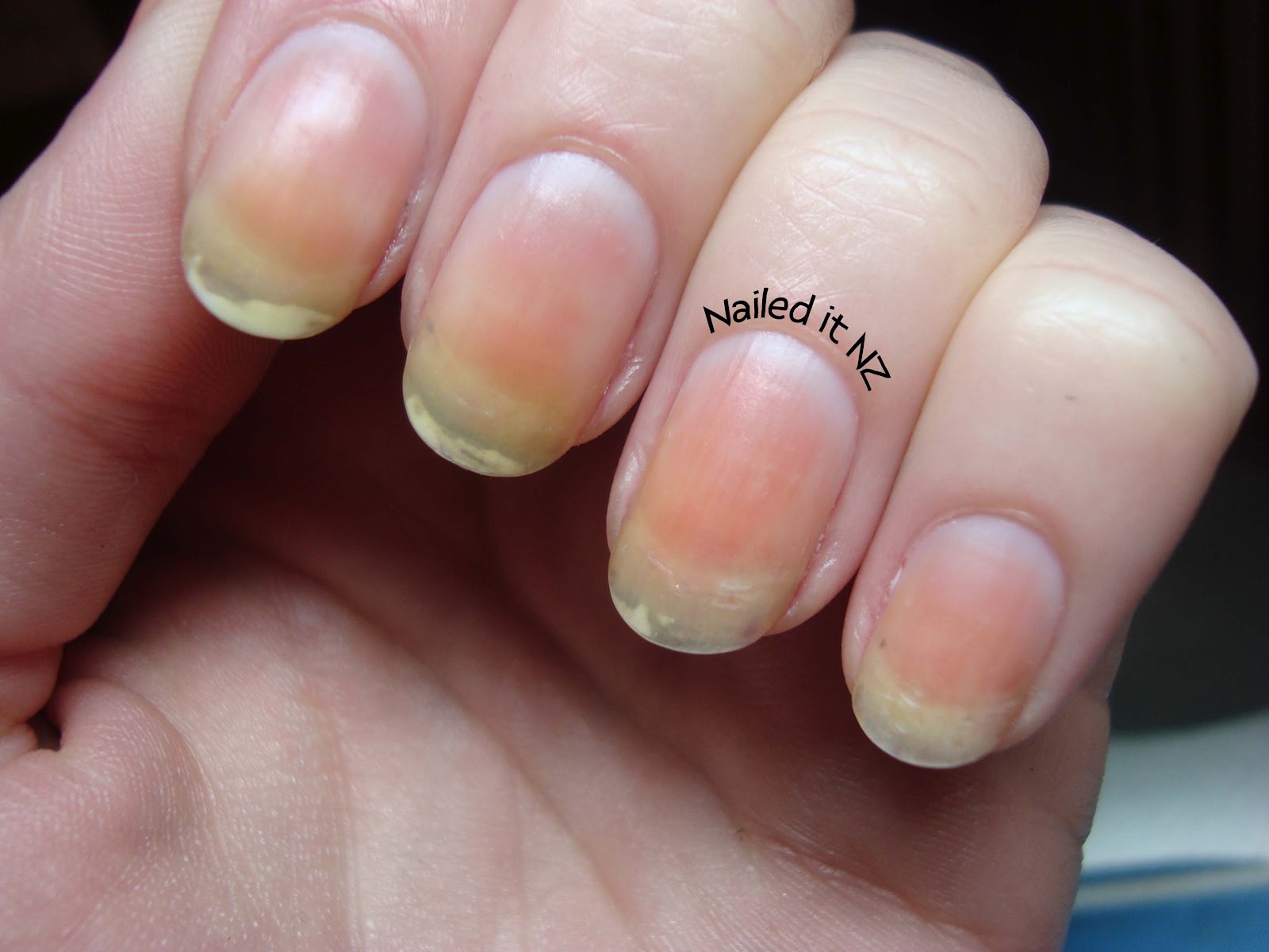 Nail Polish Stained My Nails How To Fix Them!