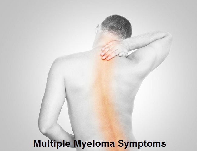 What is multiple myeloma?