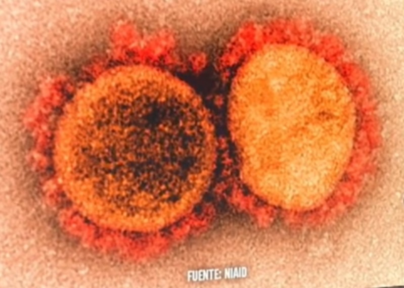 Investigan mutación del virus SARS-CoV-2  reportada en Jalisco