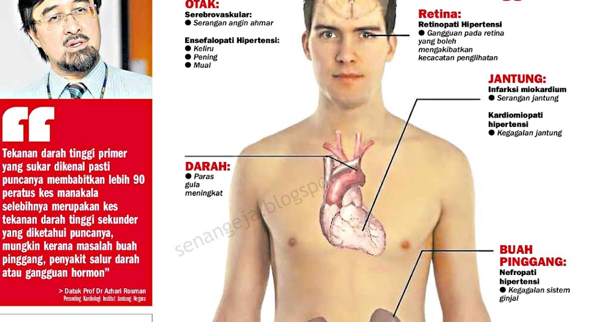 Gambar sakit jantung