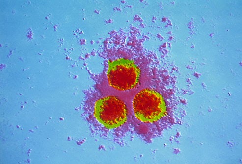Medication for chickenpox in adults
