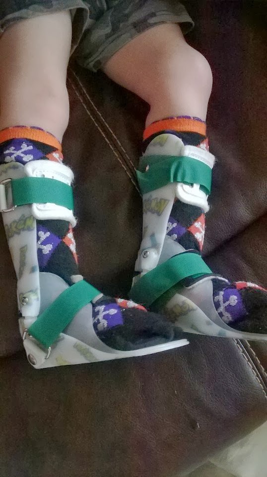 Jedi Mom AnkleFoot Orthosis (AFO) and Toddler Supramalleor Orthotics