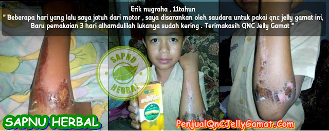 Obat Luka Gangren Tradisional Terampuh , Terbukti Manjur !! Obat Luka Gangren Tradisional Terampuh , Terbukti Manjur !!