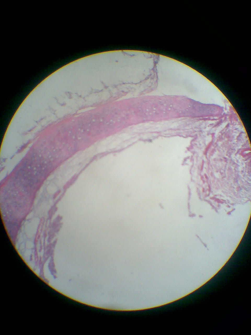 Trachea..hyalin...