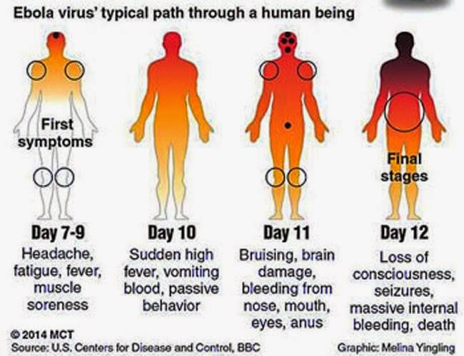 Stages Of Ebola Virus Disease