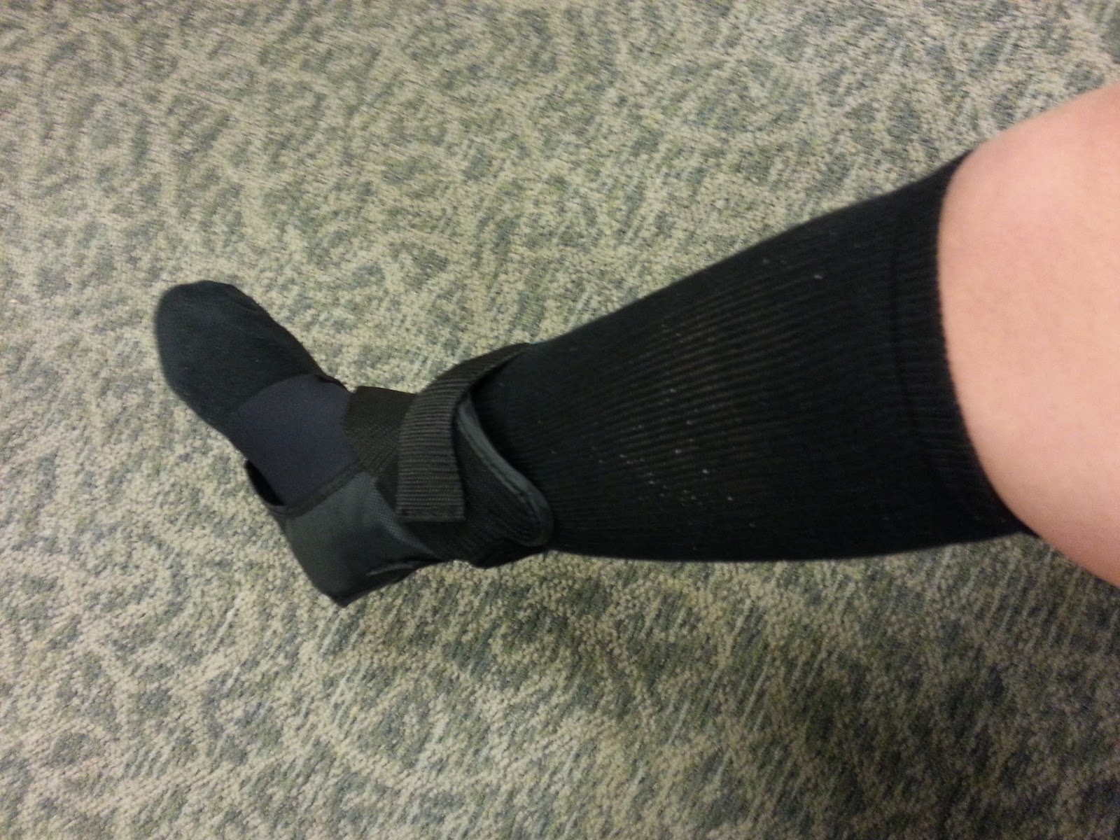 My Broken Ankle =( Cast Removal Day!