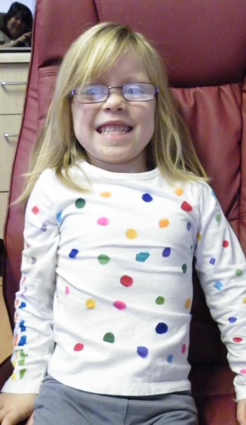 ugly spotty kid