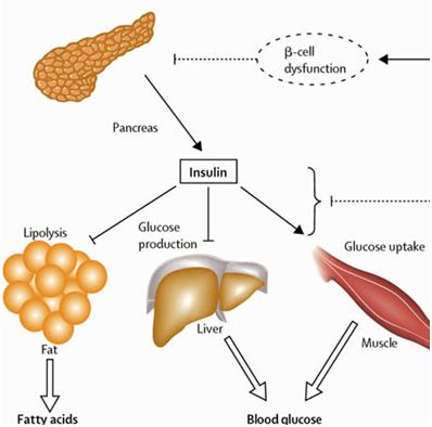 Makanan Sunnah Forever: FAKTA DIABETES