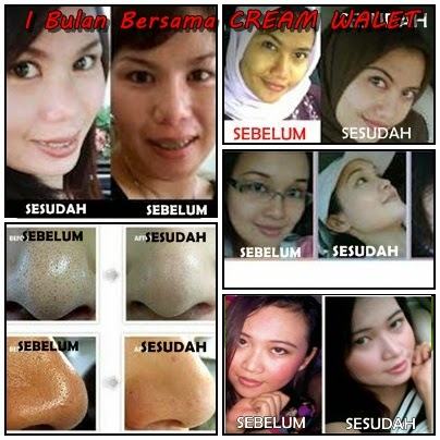 Bukti dan Testimoni Cream Walet Gold dan Serum Gold Bukti dan Testimoni Cream Walet Gold dan Serum Gold