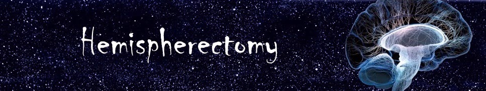 Hemispherectomy