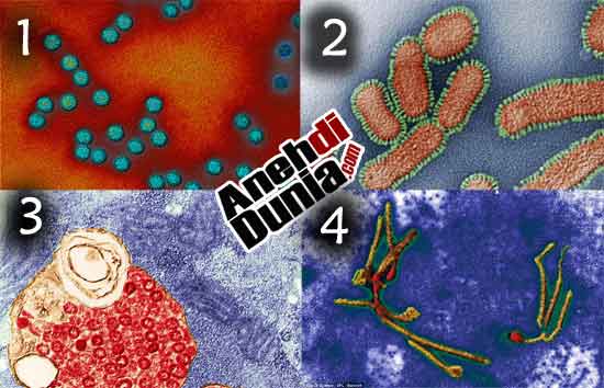 Gambar Bakteri Dan Virus Berbahaya Saat Perbesar - Berita Aneh Unik dan
