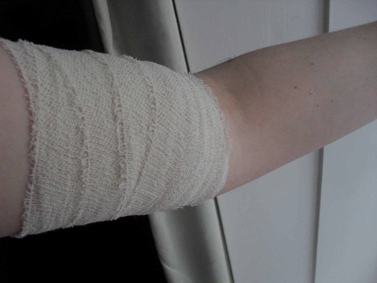 Bandage After Nexplanon at Ashley Davis blog