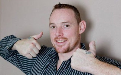 The Unusual Transplant Thumb Surgery