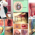 Obat Ambeien Yang Manjur Tanpa Operasi Stapler thumbnail