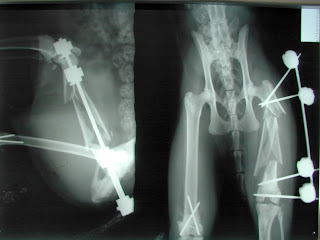 fractura femur muy grave fijador Meynard