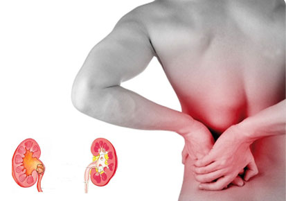 What are the initial signs of a kidney infection?