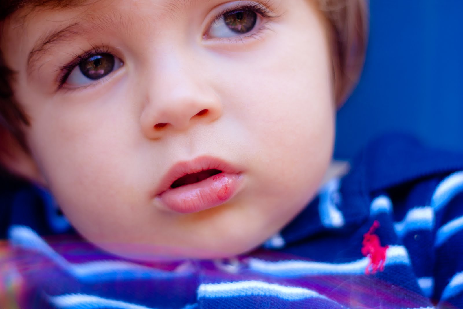 The Edwards Busted Lip