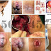 Obat Wasir Ambeien BPOM Ambeclear thumbnail