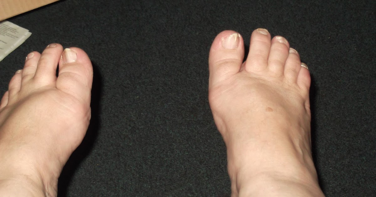 JoAnne's Ramblings Sweaty Feet and ask me something go on you know