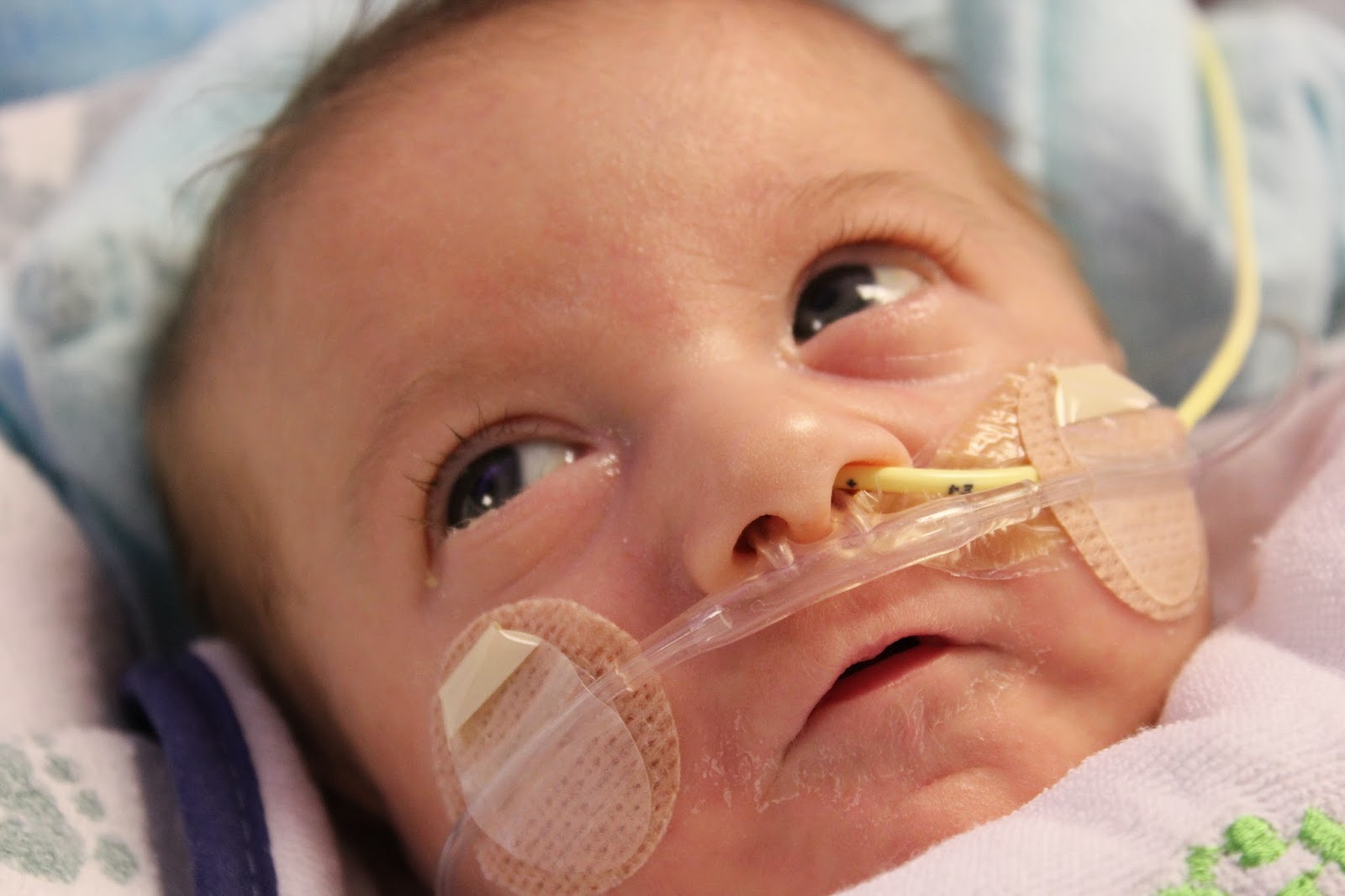 The Davises Dear Feeding Tube, I hate you! Love Always, Casey