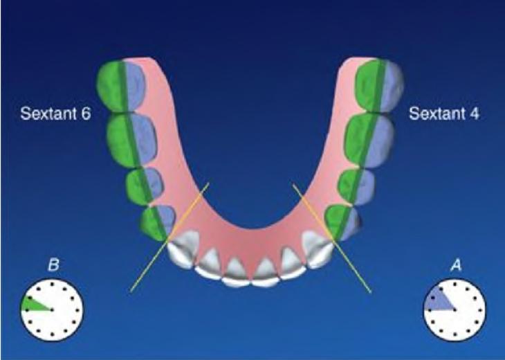 sextant of teeth dentistry lectures for mfds mjdf nbde ore principles of sextant of teeth dentistry lectures for mfds mjdf nbde ore principles of