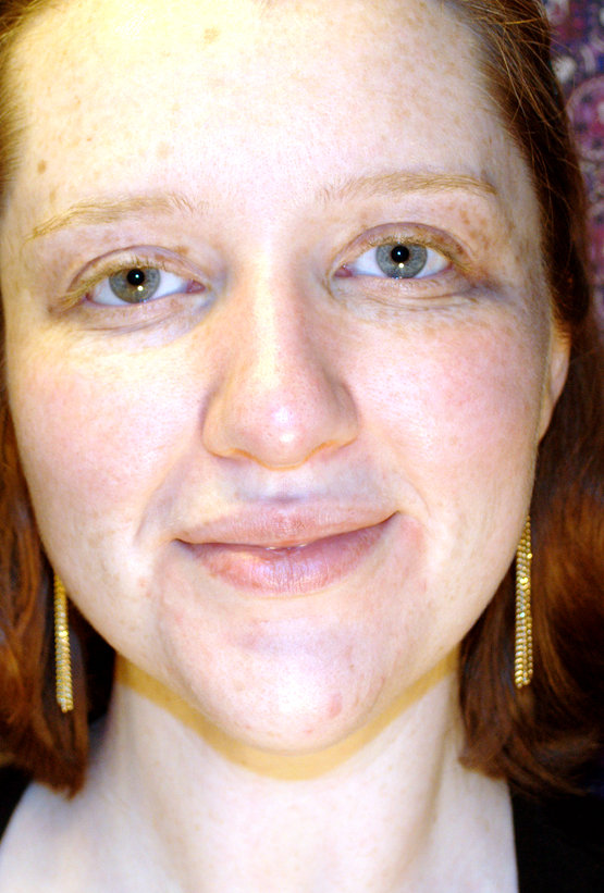 beyond the pale and freckled Face without a Stitch of Makeup, Invisible Eyebrows and Lashes