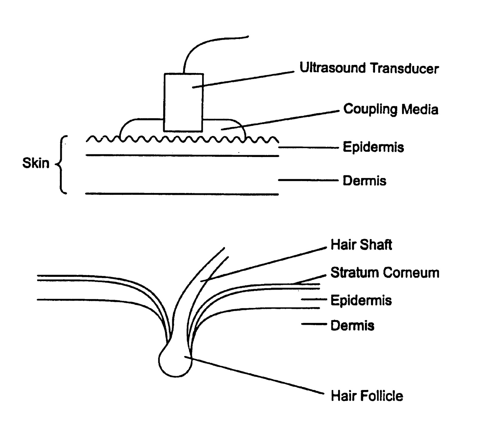 Electrotherapy for MSP Therapeutic Ultrasound