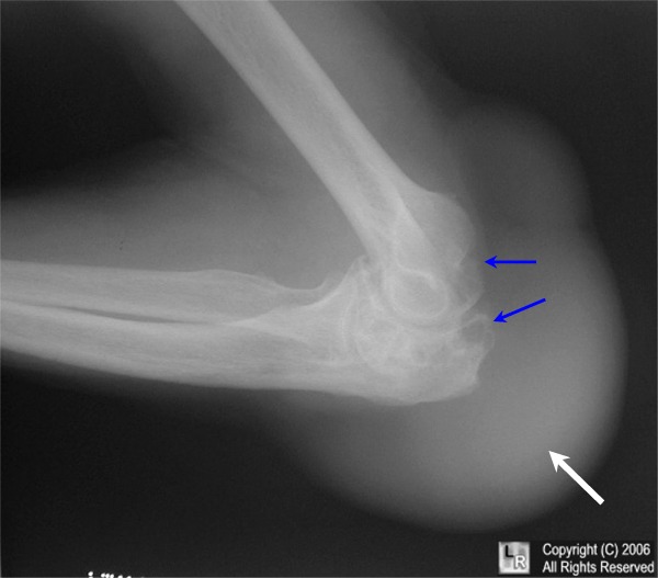 a Homeopathy expert LITHAEMIA GOUT