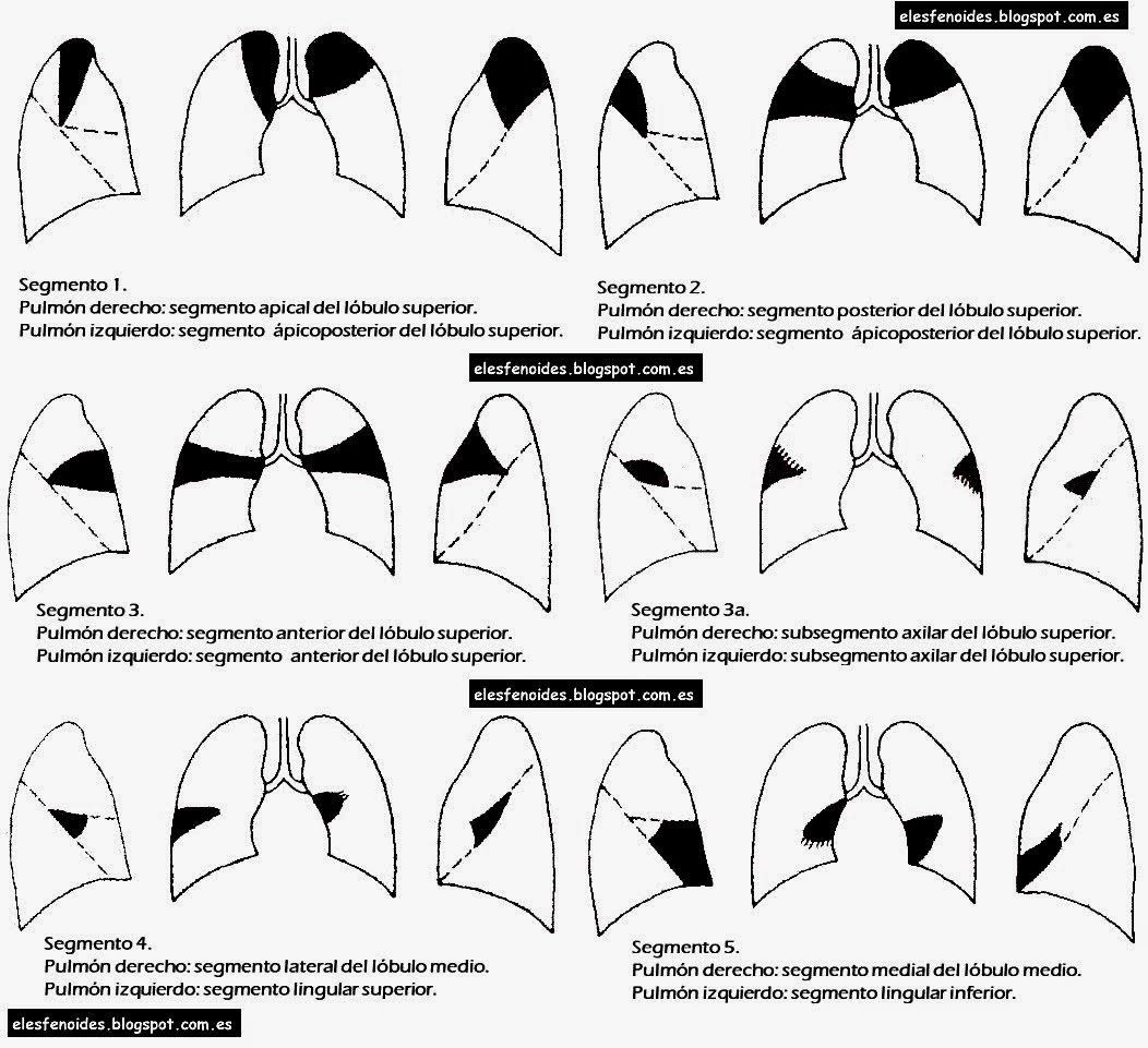 Segmentos pulmonares 1-5