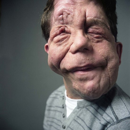 http://www.channel4.com/programmeseauty-the-beast-ugly-face-of-prejudice http://www.channel4.com/programmeseauty-the-beast-ugly-face-of-prejudice