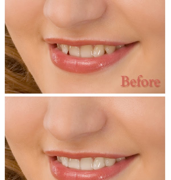 GrapicWork: Cómo blanquear los dientes en Photoshop