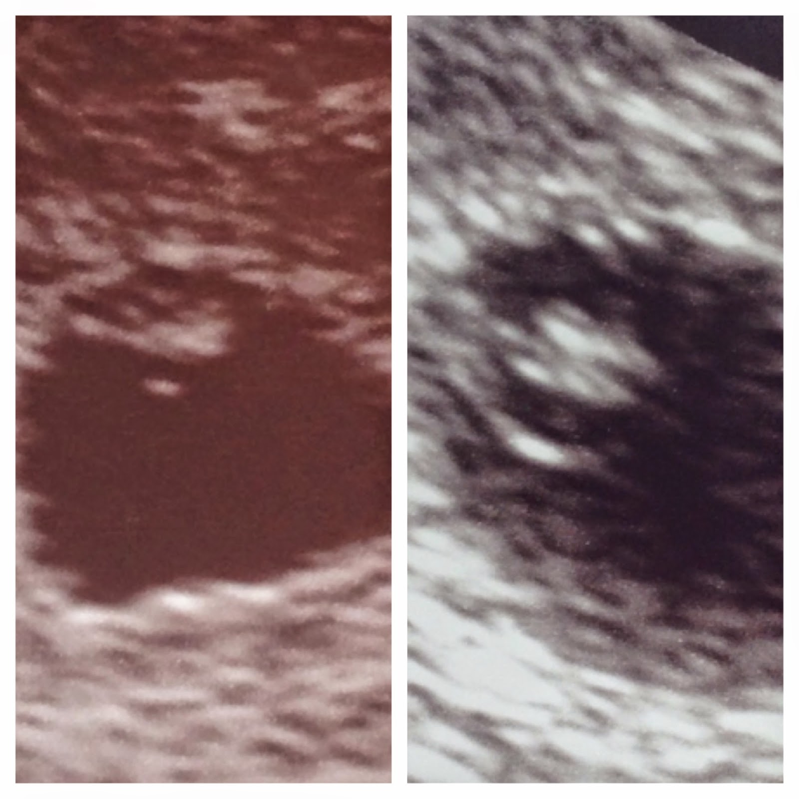 F.I.T. by Jordan Hematoma = Bed Rest