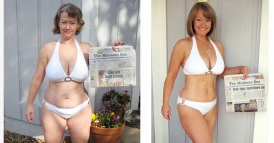 Polycystic Ovary Syndrome Diet Plan Weight Loss