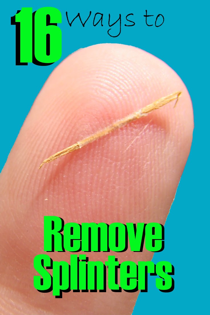 How to Remove a Splinter Fluster Buster