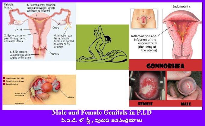 Lower Abdominal pain during Sex,సెక్స్ లో పాల్గొంటే పొత్తికడుపులో నొప్పి