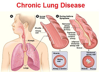 chronic lung disease pictures 